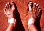 Unsere Füße im australischen Sand